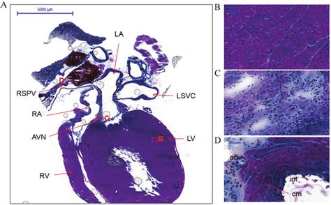 Histology of the atria, ventricles, atrioventricular node and right ...