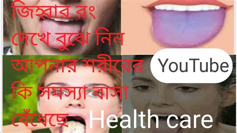 শরীরে কি রোগ বাসা বেঁধেছে জিহ্বার রং দেখে বুঝে নিন। Health Care Youtube