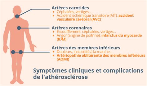 Le corps humain Convergence Infirmière Syndicat infirmière