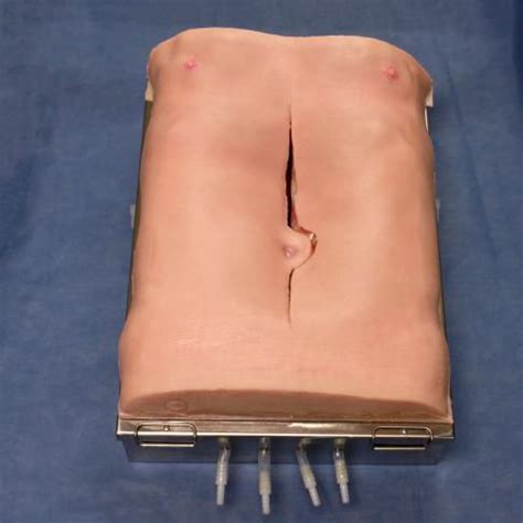 Simulateur D An Vrisme De L Aorte Abdominale Dmed De Formation