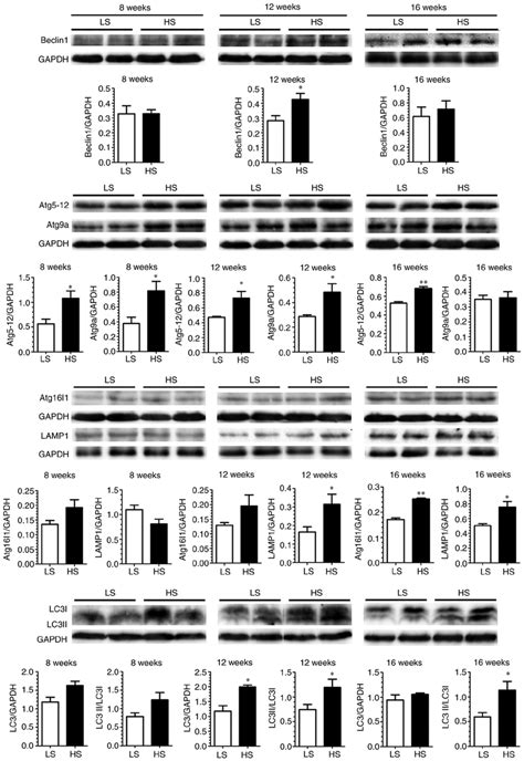 Global Upregulation Of Autophagy Related Proteins In Myocardium Of