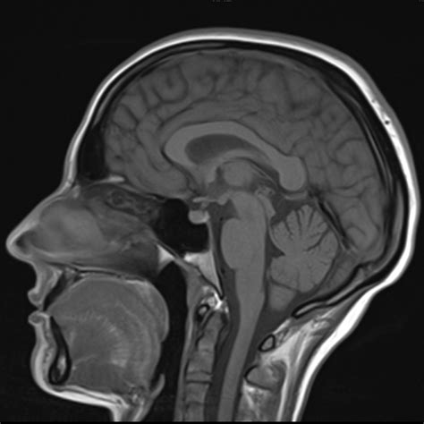 Pracownia Rezonansu Magnetycznego I Tomografii Komputerowej Pozna