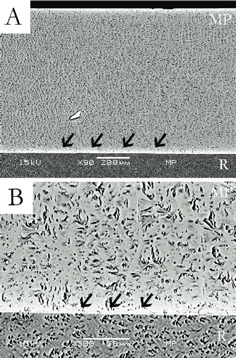 Sem Micrographs Of A Specimen Of The Bonding Resin Of Scotchbond