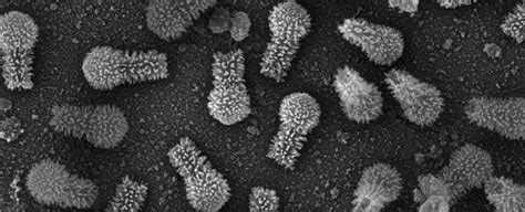 These Viruses Found In Brazil Are So Huge Theyre Challenging What We