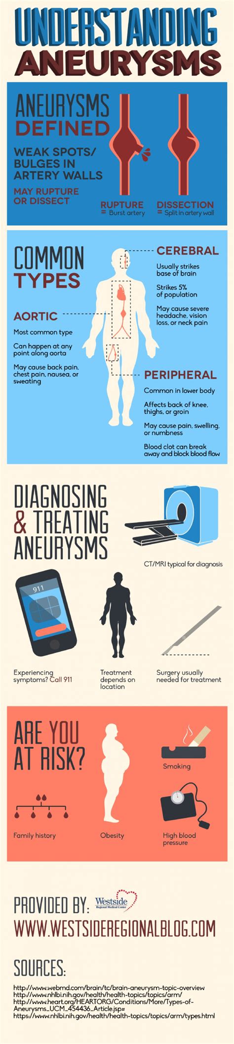 Understanding Aneurysms | Visual.ly | Nurse, Medical, Nursing school