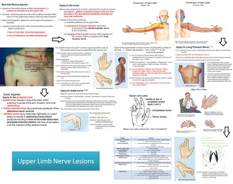 Medical Concept Maps Musculoskeletal System