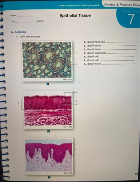 Stratified Epithelial Tissue Labeling Exercise