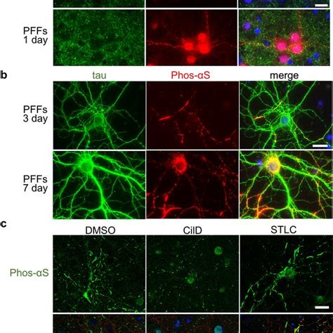 Seed Dependent Phosphorylation Of α Synuclein In Pre Synaptic Region Of