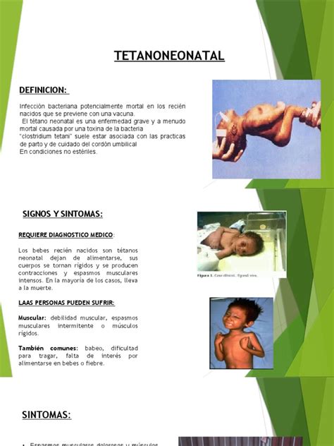 Tetano Neonatal 1 Pdf Medicina Clinica Enfermedades Y Trastornos