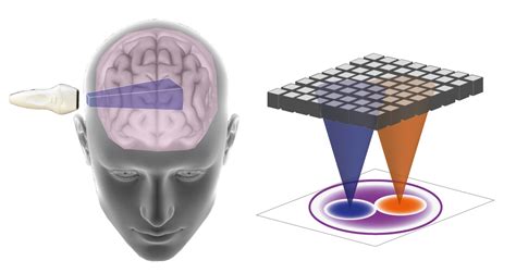 Seeing Through The Skull With 3d Ultrasound Matrix Imaging Research Communities By Springer Nature