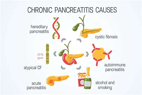 Pancreatitis: Causes, Symptoms, and Homeopathic Treatment ...