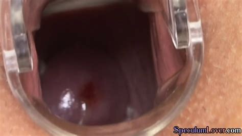 Speculum Babe Closeup Toys Pussy With Vibrator Before Gaping