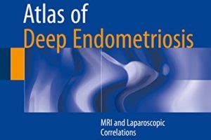 Atlas Of Deep Endometriosis Instituto Crispi De Cirurgias