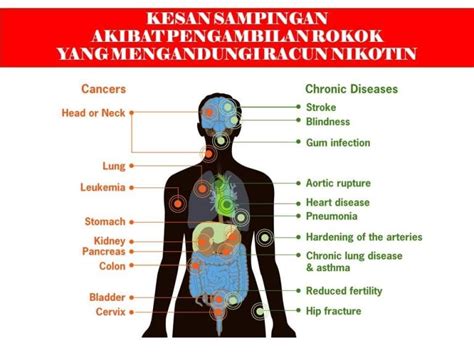 Bahaya Vape Rokok Elektronik E Cigarette Kkm