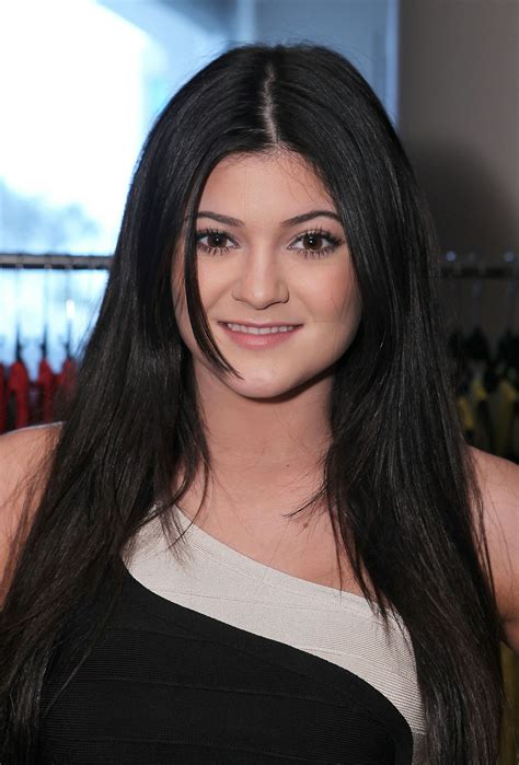 Kylie Jenner before and after plastic surgery