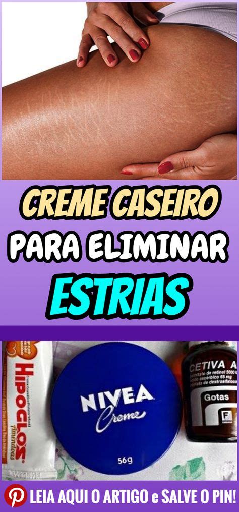 Tratamento Caseiro Secreto Para Eliminar Estrias Creme Caseiro Para