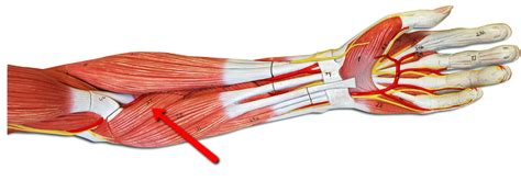 Pronator Teres Superficial Muscle On Anterior Olecranon Origin Medial