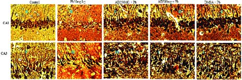 Composite Photomicrograph Of Ca1 And Ca3 Hippocampal Subfields Of The