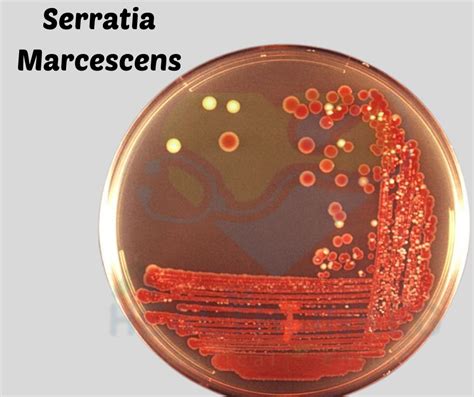 Best Plan For Serratia Marcescens Urinary Tract Infection Treatment 2024 - healthlinkeg