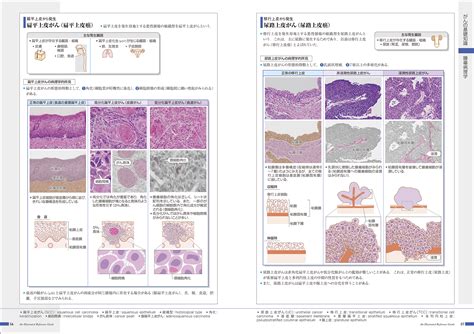 [新刊]『がんがみえる』医学部各学年の使い方 Informa By メディックメディア