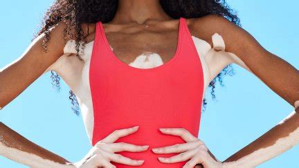 Winnie Harlow Model Women Dark Skin Brunette Curly Hair Hands On Hips Women Outdoors