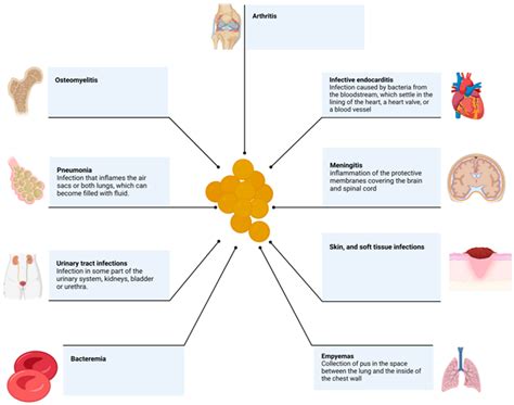 Staphylococcus Aureus Infection