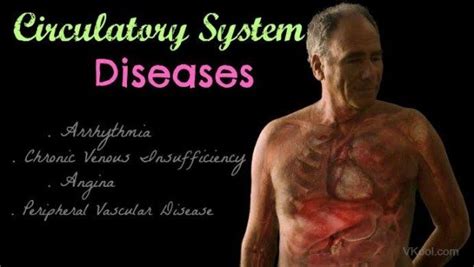 Diseases Of Circulatory System