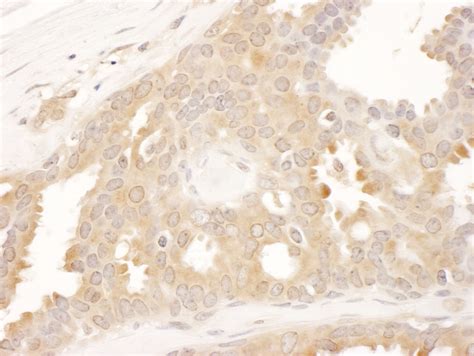 CCT8 Antibody (A303-448A)
