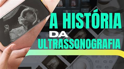 DESCUBRA COMO SURGIU A ULTRASSONOGRAFIA RADIOLOGIA YouTube