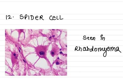 Spider Cell Medizzy