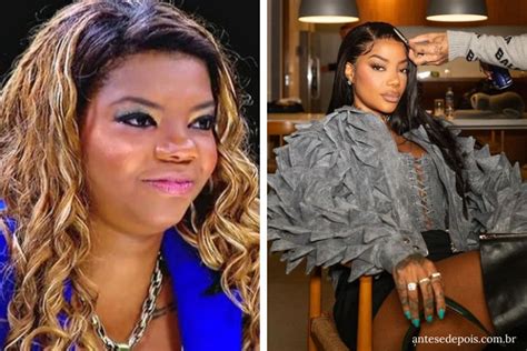 Ludmilla Antes E Depois Da Cantora Ap S Cirurgias