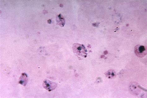 Free Picture Immature Vivax Schizont Three Chromatin Masses Magnified 1125x