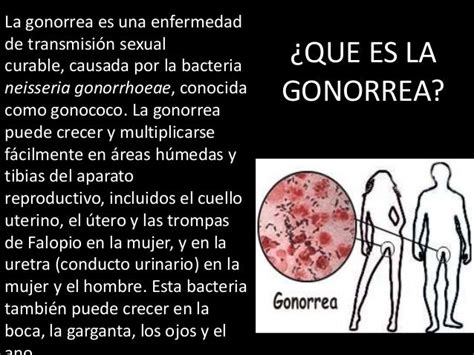 Gonorrea