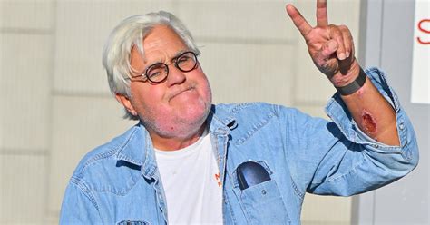 Jay Leno Breaks Multiple Bones In Motorcycle Accident Cbs Boston