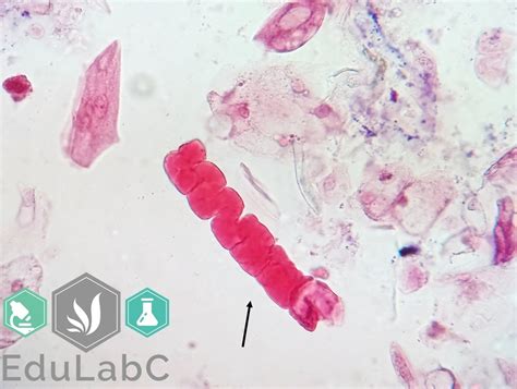 Los cilindros céreos son llamados así por su aspecto que es similar a