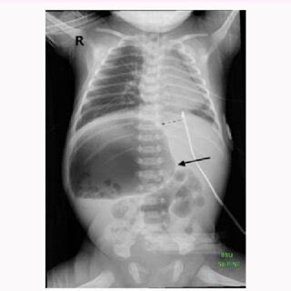 Antero Posterior Chest And Abdomen Radiograph Chest Normal Positioned