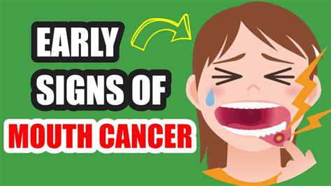 Mouth Cancer Early Warning Signs