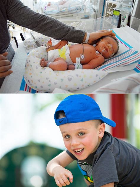 Meet 51 Babies Who Were Born Too Soon And See How Far Theyve Come