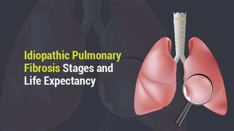 Pin on Lungs/Pulmonary