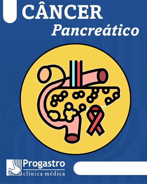 Câncer De Pâncreas O Que Você Precisa Saber Instituto Progastro