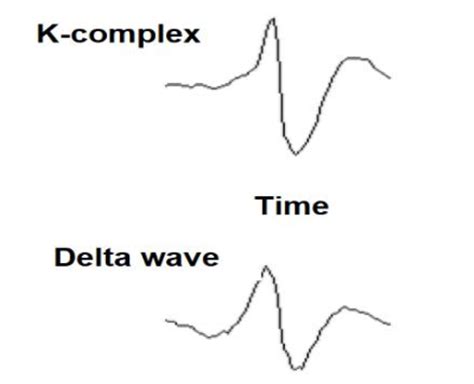 Brain waves: K-complex and sleep spindle [49]. | Download Scientific ...