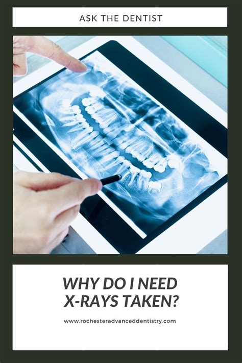 Why Do I Need Dental X Rays Dentistry Preventive Dentistry Dental