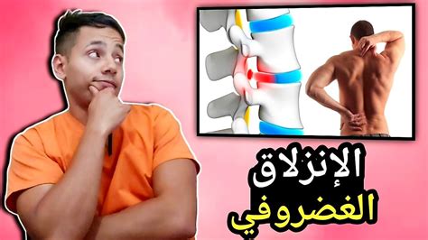 الإنزلاق الغضروفي أسبابه علاجه وعلاقته بالسياتيك ألم الظهر YouTube