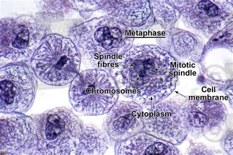 Metaphase Microscope