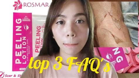 ROSMAR PEELING LOTION TOP 3 FAQ S Ms Sungit YouTube