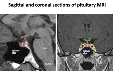 Pituitary Gland Diagram | Quizlet