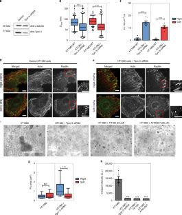 Stopping Transformed Cancer Cell Growth By Rigidity Sensing Nature