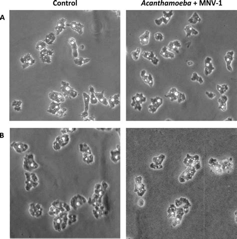 Light Micrographs Of Acanthamoeba Trophozoites With Or Without Virus Download Scientific