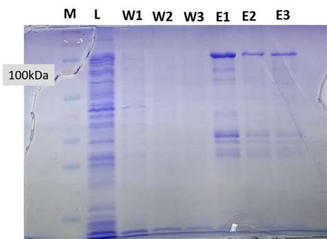 1683 questions with answers in PROTEIN PURIFICATION | Scientific method