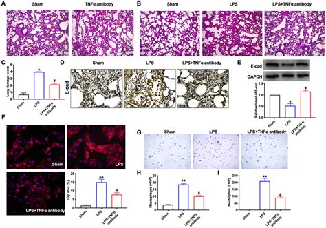 Silencing Of Lncrna Fgd As Prevents Inflammation In Acute Pneumonia